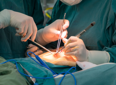 General Surgery General Surgery